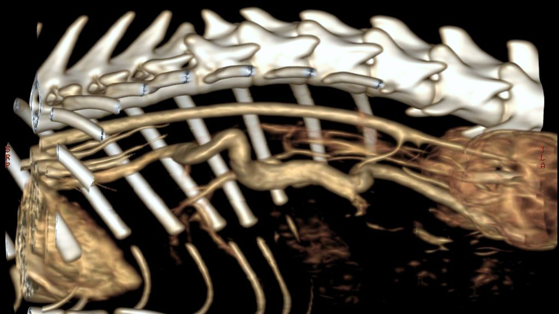 Neurologie